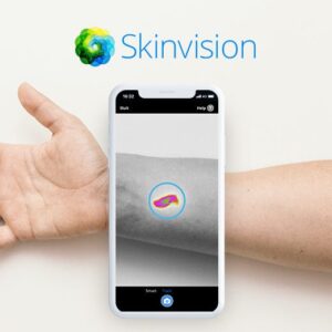 SkinVision تشخیص سرطان پوست، فقط با یک عکس باشگاه پرورش محصول tegory%