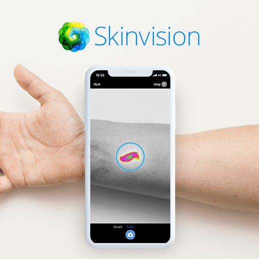 SkinVision تشخیص سرطان پوست، فقط با یک عکس باشگاه پرورش محصول tegory%
